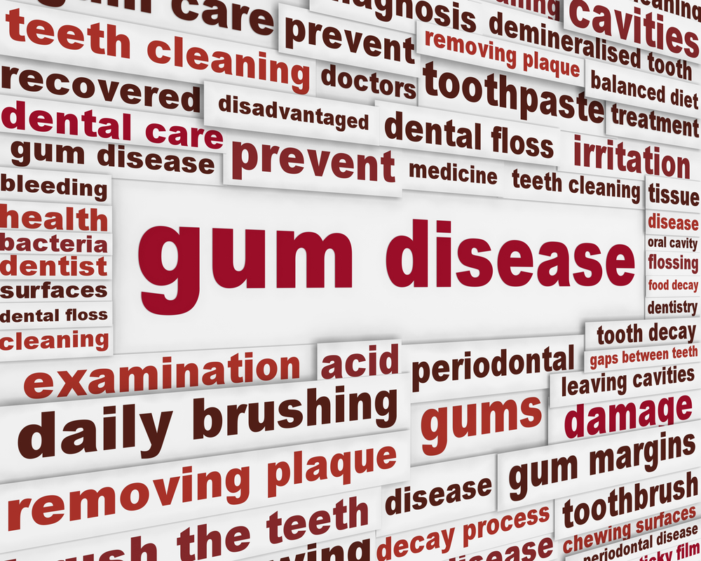 gum disease.jpg